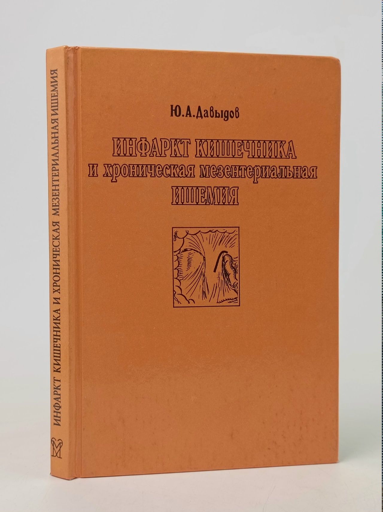 Обложка: Инфаркт кишечника и хроническая мезентериальная ишемия