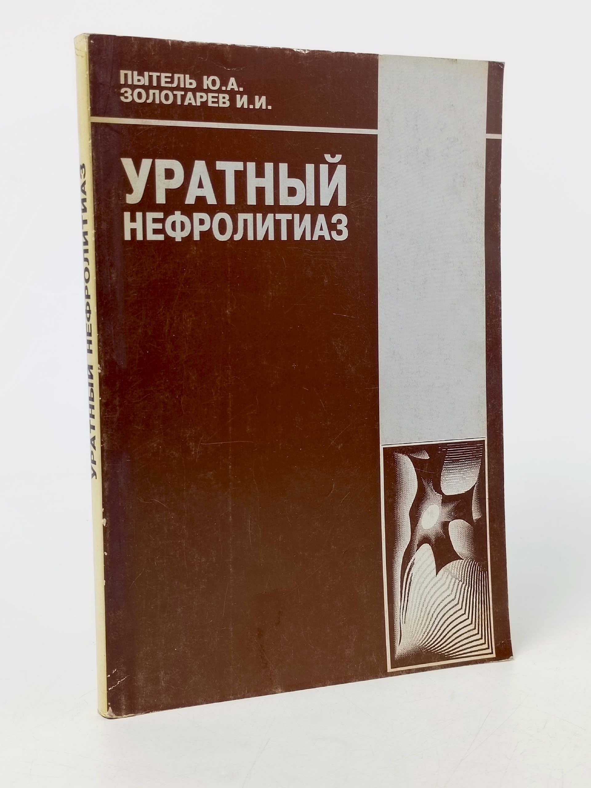 Обложка: Уратный нефролитиаз