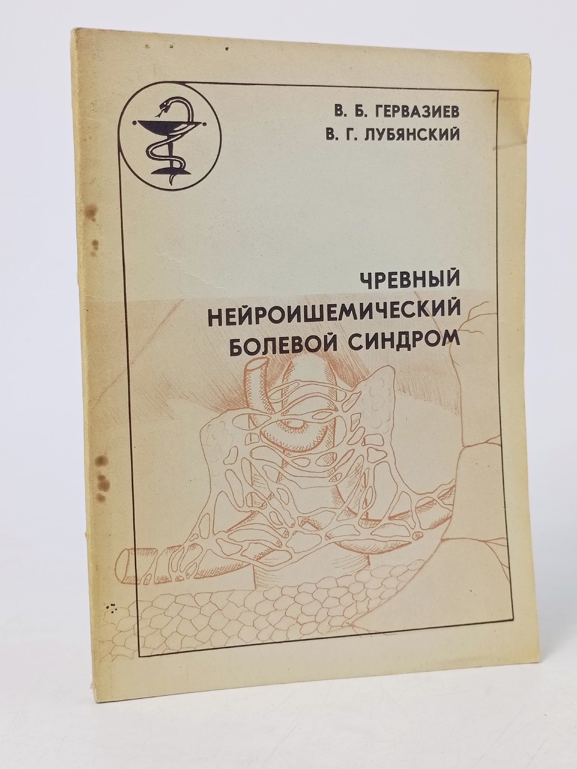 Обложка: Чревный нейроишемический болевой синдром