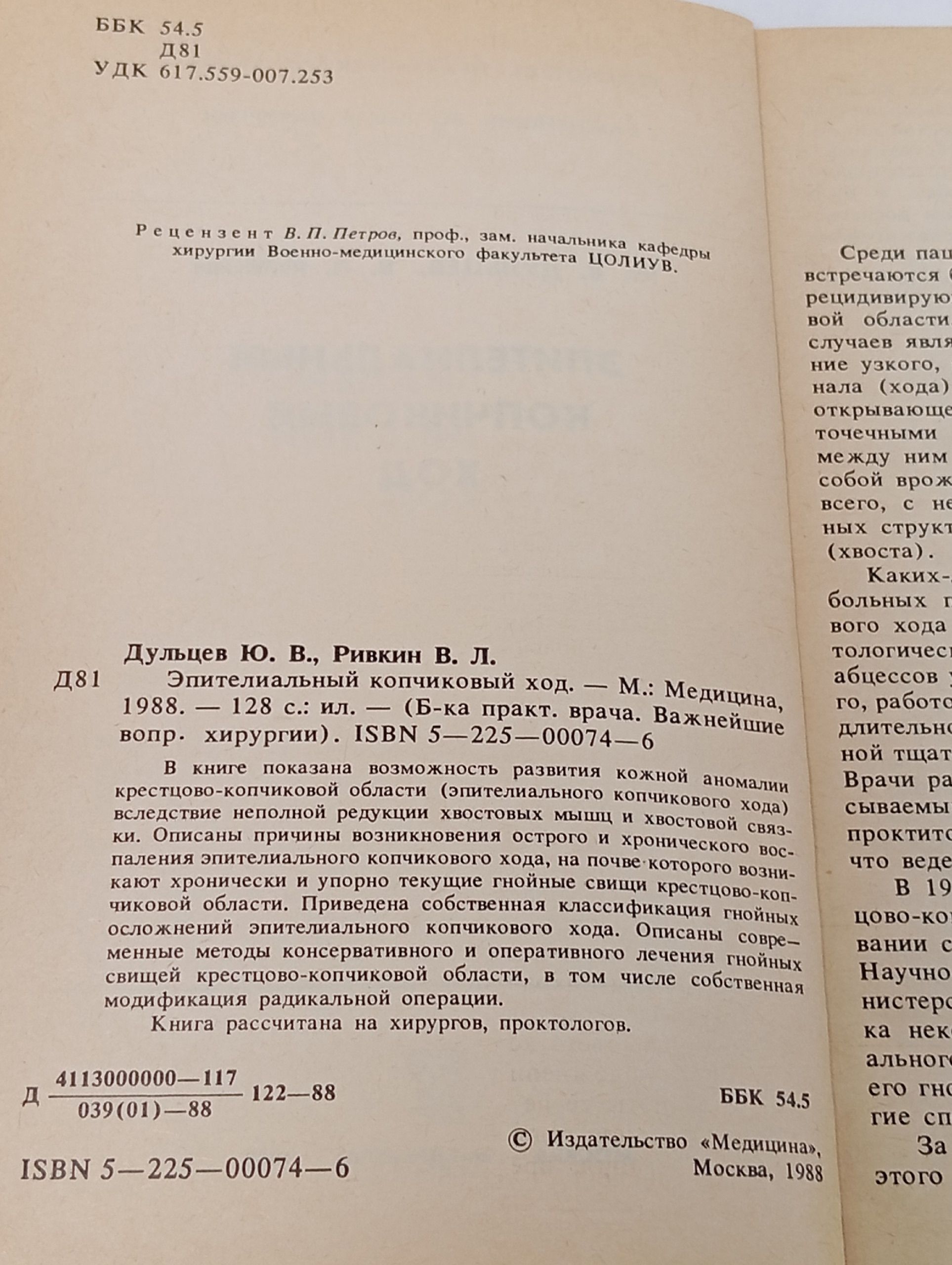 Эпителиальный копчиковый ход